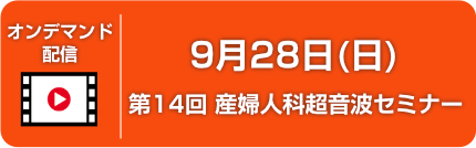 オンデマンド配信