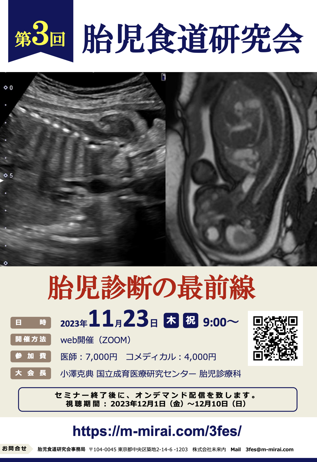 第3回胎児食道研究会チラシ