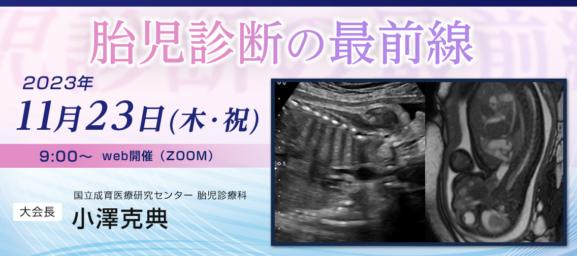 第3回胎児食道研究会