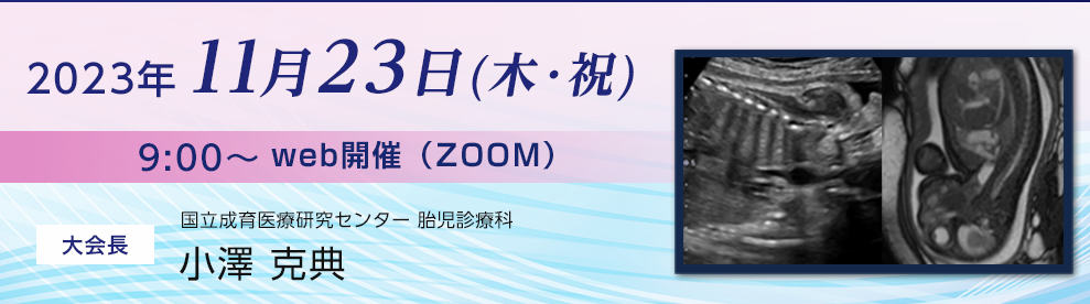 第3回胎児食道研究会