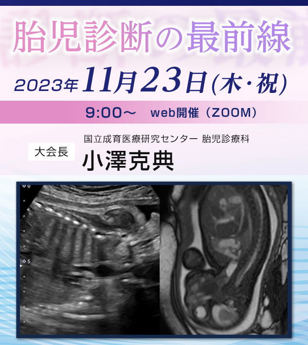 第3回胎児食道研究会