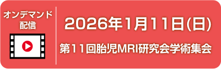 オンデマンド配信